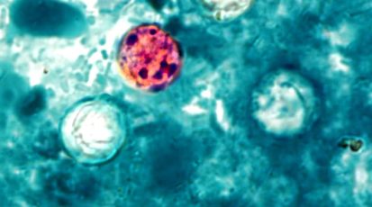 ciclosporiasi stati uniti