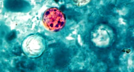 ciclosporiasi stati uniti